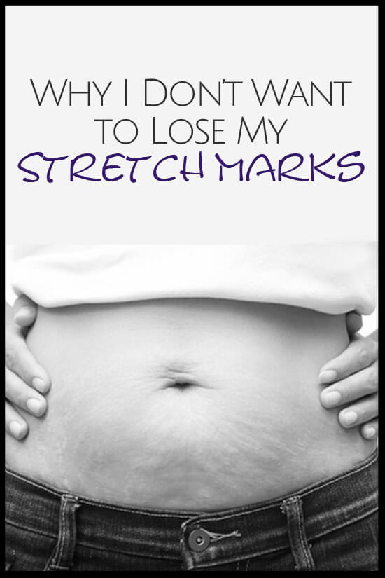 Why I don't want to lose my Stretch Marks by Lexi
